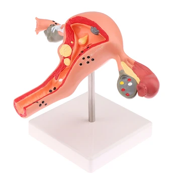 1шт Медицинский реквизит Модель Патологической матки Анатомическая модель яичников Инструмент для изучения анатомического сечения
